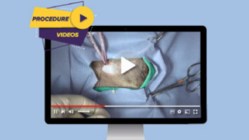 Guided Procedure Videos Banner